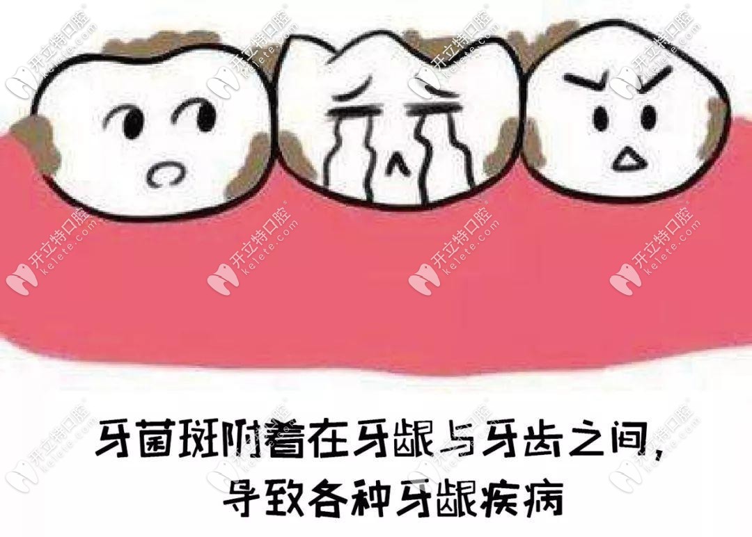 牙菌斑不清楚會(huì)出現(xiàn)各種牙齒疾病