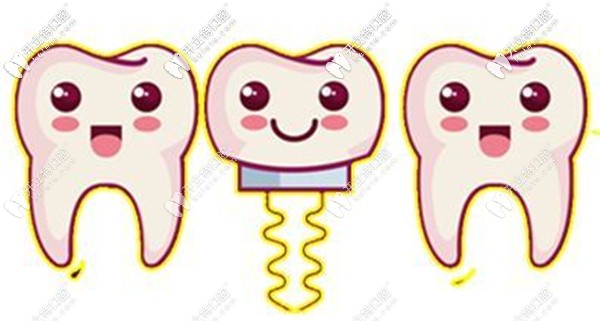 承德可米口腔種植牙