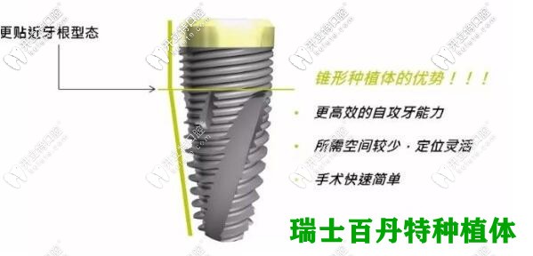 瑞士百丹特種植牙優(yōu)勢
