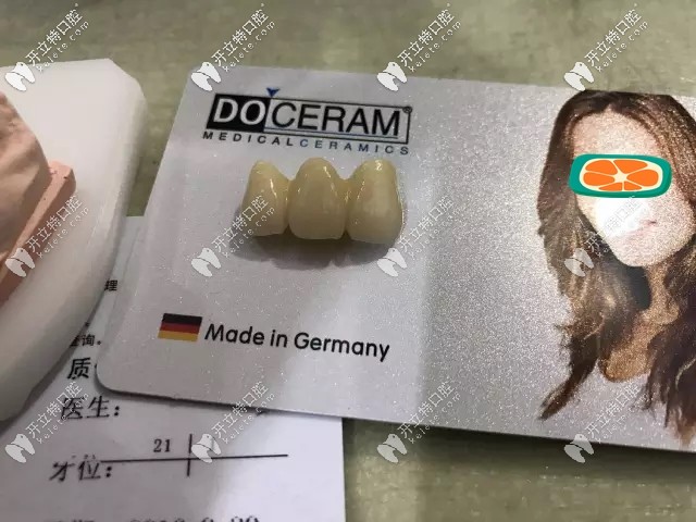 杜塞拉姆氧化鋯全瓷牙優(yōu)點(diǎn)