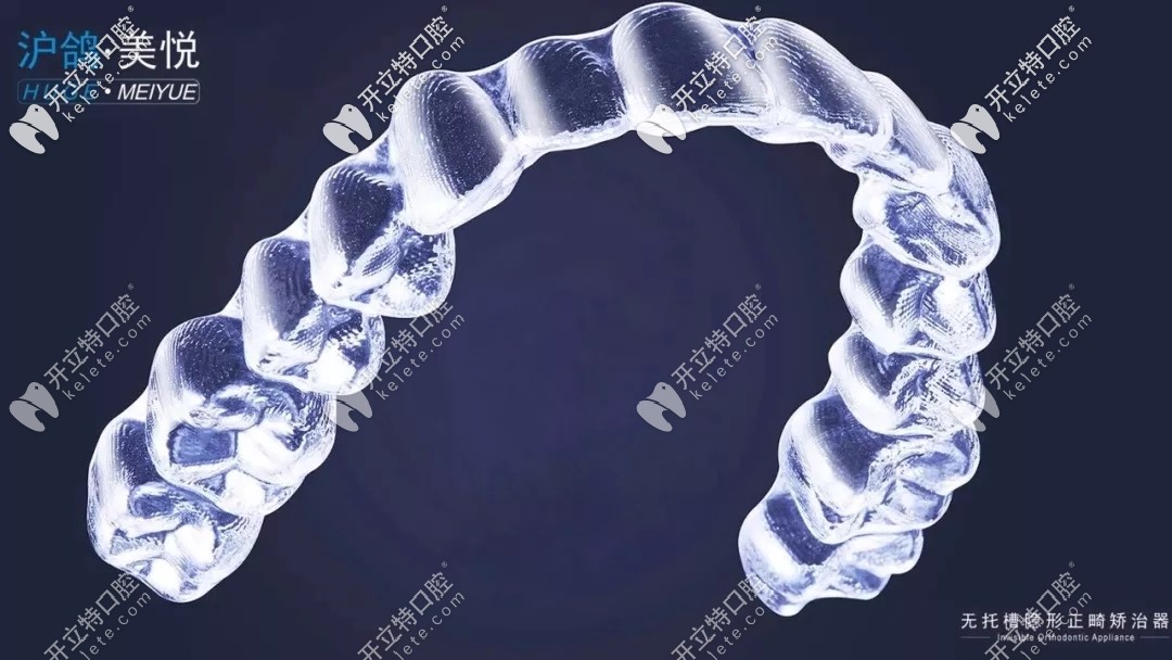 滬鴿美悅矯正器咋樣?關(guān)于滬鴿隱形牙套的價格及病例這都有