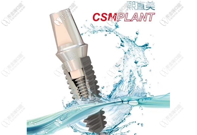 韓國熙直美種植體