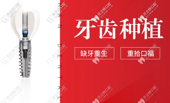 貴陽德韓口腔種植牙怎么樣？種牙技術好的醫(yī)生介紹奉上