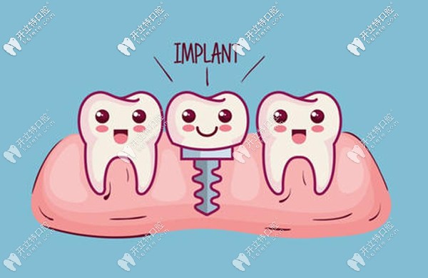 正常拔牙后建議1年內(nèi)完成種植