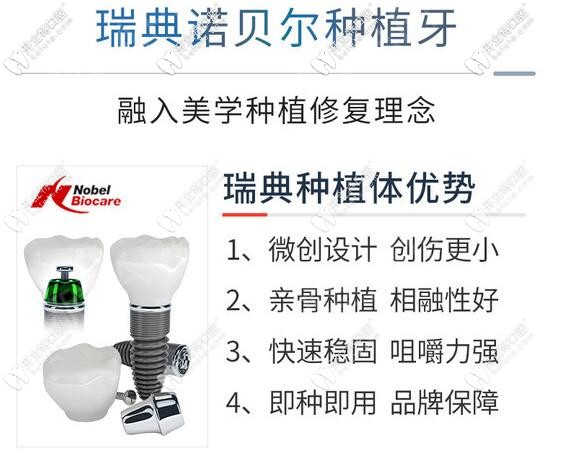 深圳勝健口腔瑞典諾貝爾種植牙優(yōu)勢 深圳勝健口腔瑞典諾貝爾種植牙優(yōu)勢