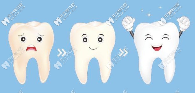 美白牙齒的方法有哪些？這有美牙五大方法效果及優(yōu)勢對比