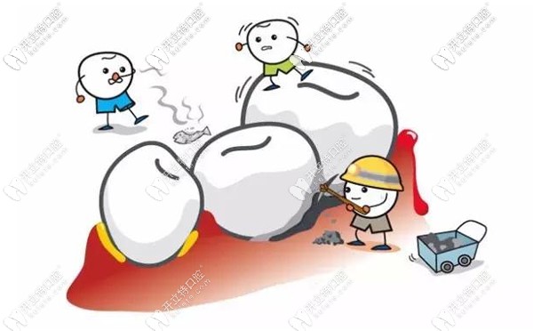 廣州德倫口腔收費標(biāo)準(zhǔn)及地址亮相，看牙弄清價格不迷路哦~