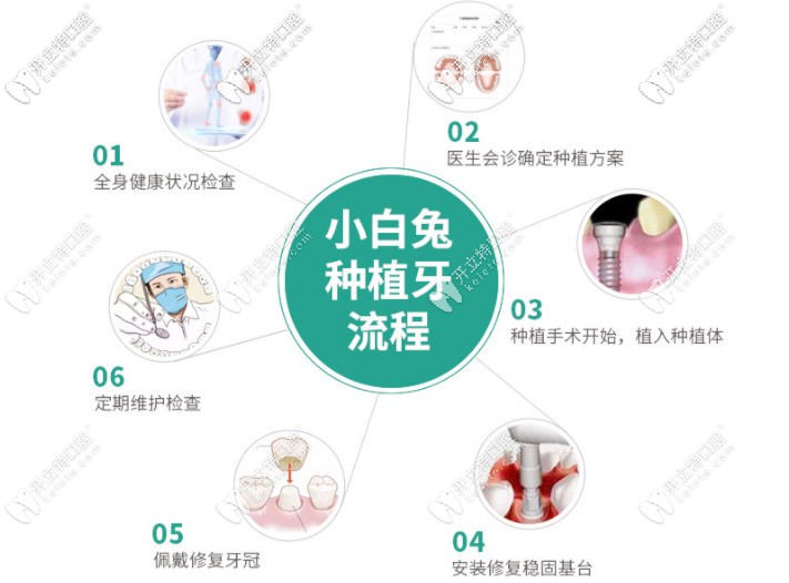 小白兔家種植牙的流程