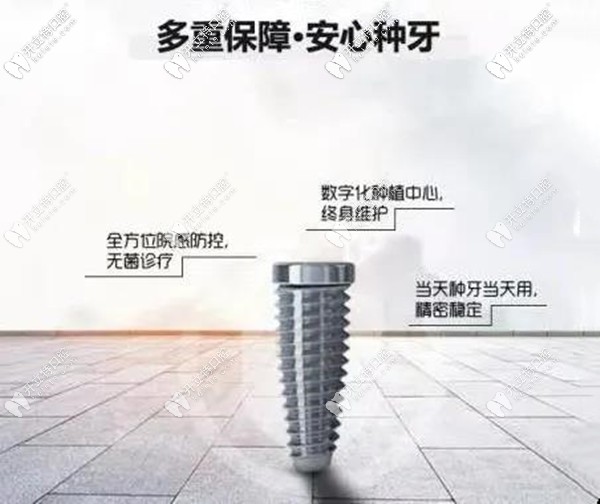 廈門麥芽與瑞典諾?？品N植體聯(lián)合,做Nobel種植牙可終身質(zhì)保