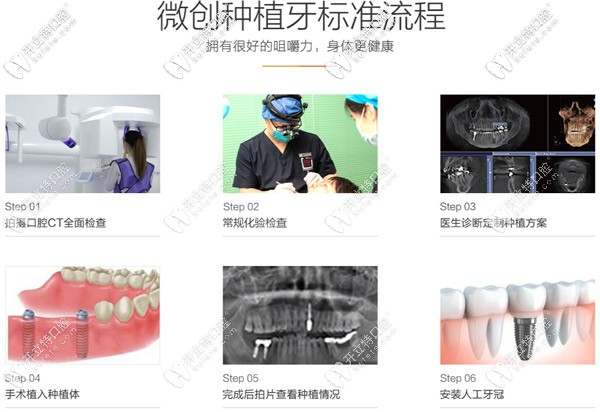 青島維樂口腔的微創(chuàng)種植牙標(biāo)準(zhǔn)流程