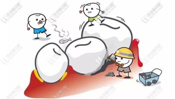 東營(yíng)洗牙如何收費(fèi)的