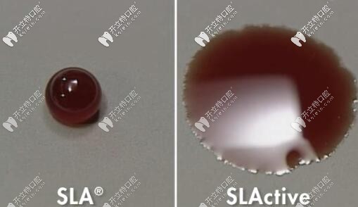 種植體表面處理技術(shù)