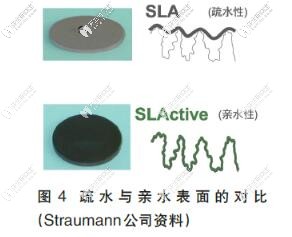 親水種植體與非親水種植體表面區(qū)別