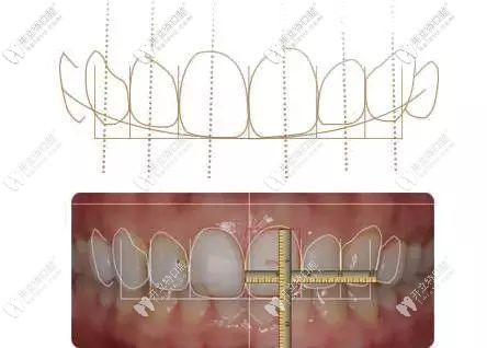 牙博士口腔牙齒矯正美學(xué)標(biāo)準(zhǔn)