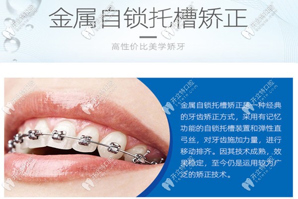 汕頭傳統(tǒng)牙齒矯正多少錢