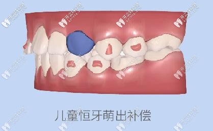 為兒牙萌出提供空間