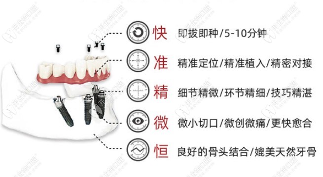 數(shù)字化微創(chuàng)種植牙特點(diǎn) 數(shù)字化微創(chuàng)種植牙特點(diǎn)
