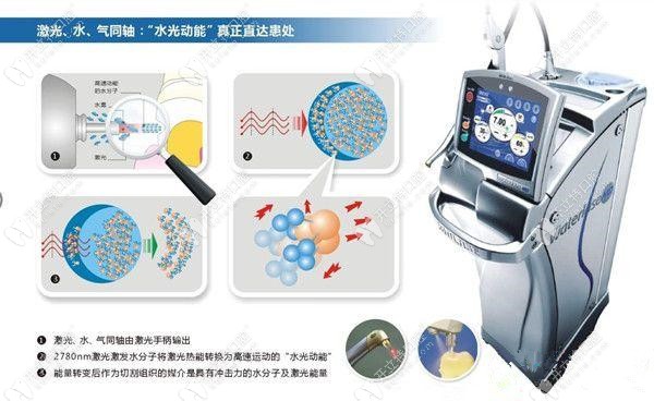 水激光種植的過程