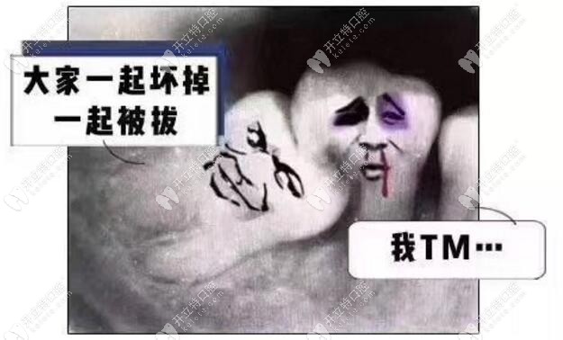 智齒空間不足的圖片-需盡快拔除