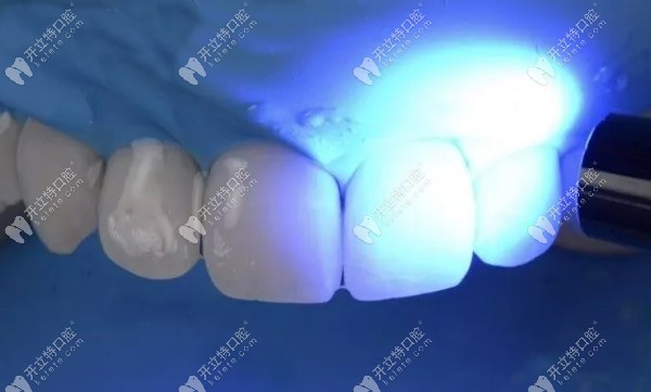 用甘油凝膠實(shí)現(xiàn)光固化程序