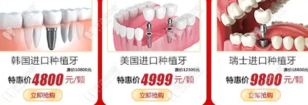 廣大口腔種植牙特惠