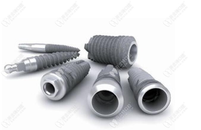 登騰種植牙的費用