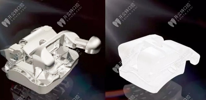 非凡矯正器零件