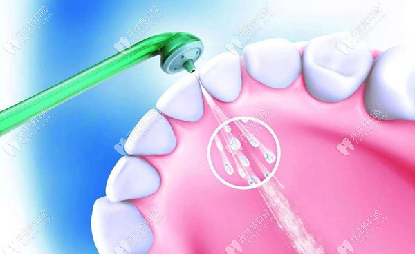 皓得適與皓齒美白的區(qū)別是什么 皓得適與皓齒美白的區(qū)別是什么