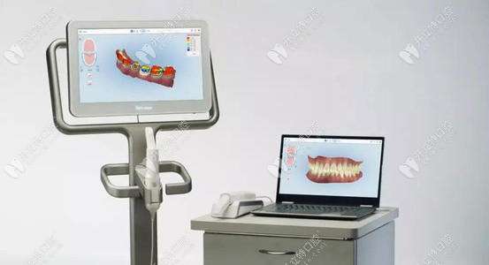 口掃設備的外觀 口掃設備的外觀