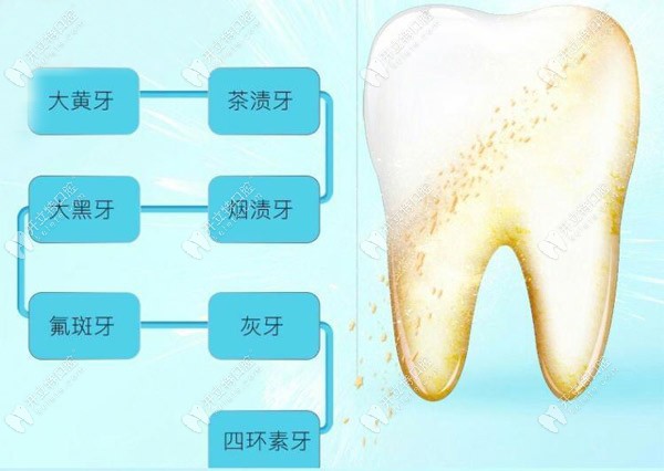 以下這些情況都適合做皓得適美白 以下這些情況都適合做皓得適美白
