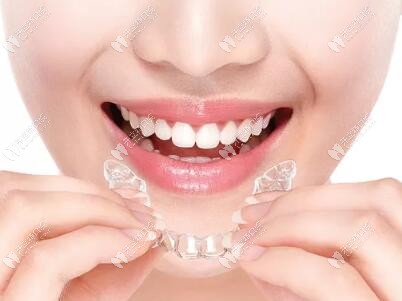 無托槽隱形矯治器