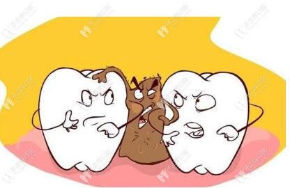 塞牙導(dǎo)致食物鑲嵌