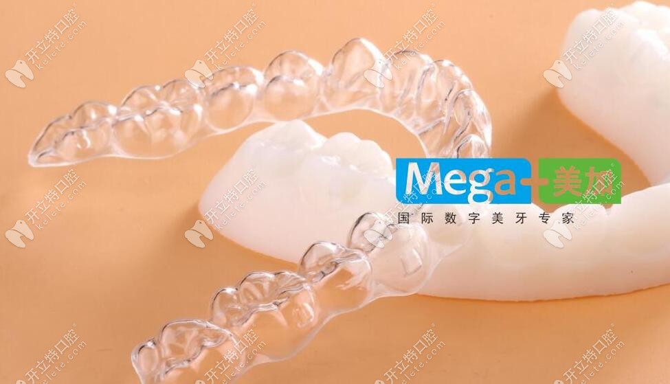 美加易齊矯正器展示圖