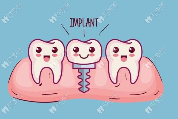 種植牙修復(fù)技術(shù)