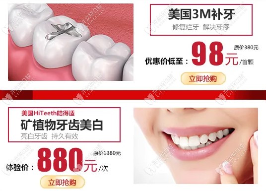 廣州廣大口腔美國(guó)3m補(bǔ)牙首顆優(yōu)惠