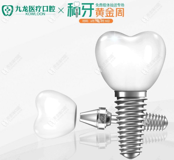 珠海九龍口腔韓國登騰,奧齒泰進(jìn)口種植體首顆低至塵埃啦