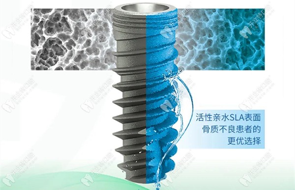 泰山TK-GY根型牙種植體