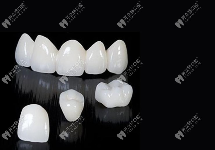 美國進(jìn)口全瓷牙透光性特別好