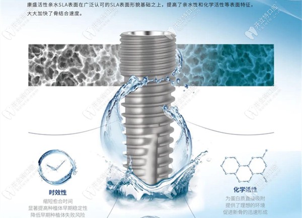 康盛植體均為骨水平設(shè)計