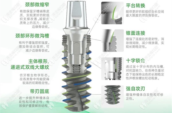 山東泰山種植體的內(nèi)部結(jié)構(gòu)介紹