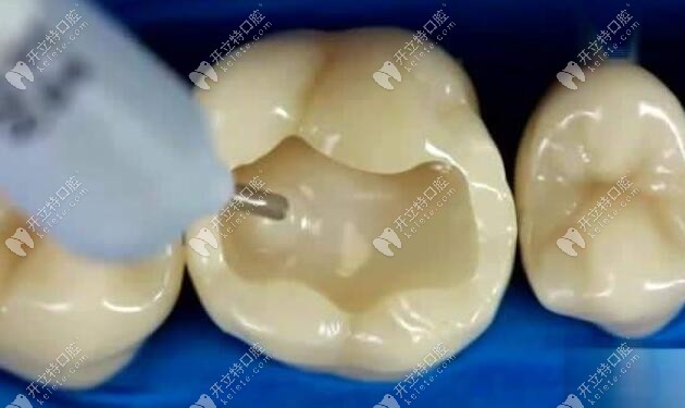 樹脂材料粘接力比較強