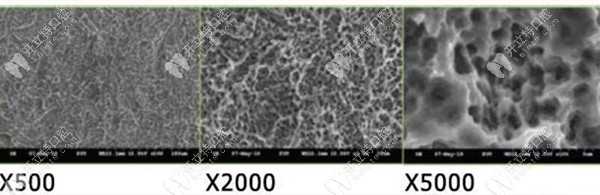 放大5000倍的植體表面