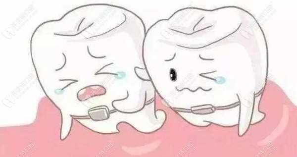 牙齒二次矯正有啥危害