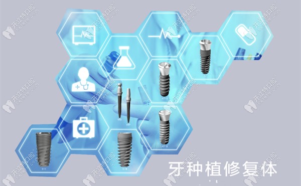 安聯(lián)種植體產(chǎn)品介紹