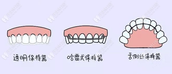常見保持器類型
