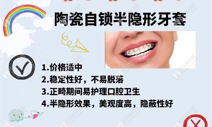 陶瓷半透明托槽的解說