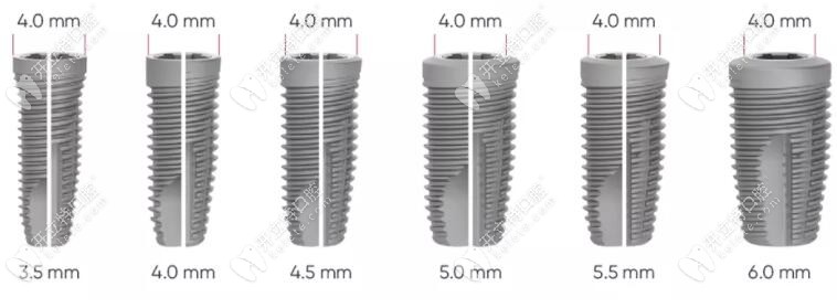 neoss種植牙型號