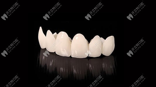 各種牙冠的價格表