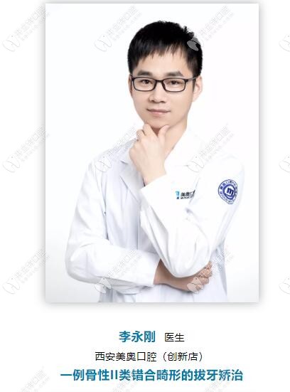 李永剛西安美奧