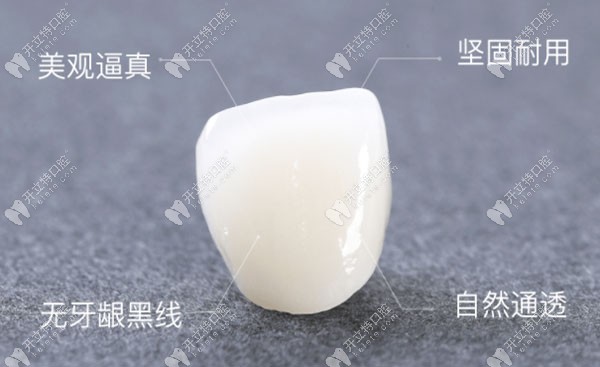 全瓷牙冠的優(yōu)勢介紹圖